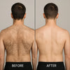 BackBlade Pro™ | Effortlessly remove hairs